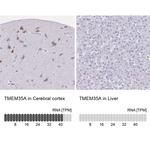 TMM35 Antibody