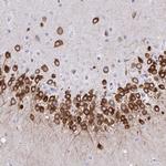 TMM35 Antibody in Immunohistochemistry (IHC)