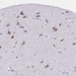 TMM35 Antibody in Immunohistochemistry (IHC)