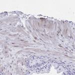 TMM35 Antibody in Immunohistochemistry (IHC)