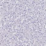 TMM35 Antibody in Immunohistochemistry (IHC)