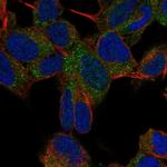 TMM35 Polyclonal Antibody