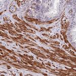 GAS2L3 Antibody in Immunohistochemistry (Paraffin) (IHC (P))