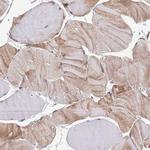 GAS2L3 Antibody in Immunohistochemistry (Paraffin) (IHC (P))