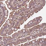 GAS2L3 Antibody in Immunohistochemistry (Paraffin) (IHC (P))
