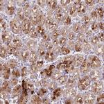 LIPJ Polyclonal Antibody