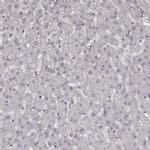 KRT74 Antibody in Immunohistochemistry (Paraffin) (IHC (P))