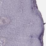 KRT74 Polyclonal Antibody