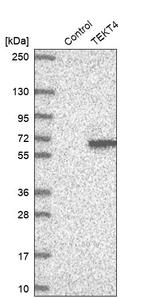 TEKT4 Antibody in Western Blot (WB)