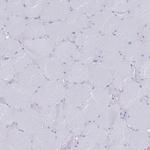 MAT1A Antibody in Immunohistochemistry (Paraffin) (IHC (P))