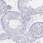 MAT1A Polyclonal Antibody