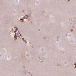 KCNG2 Antibody in Immunohistochemistry (IHC)