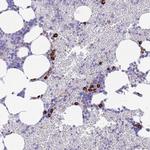 ZFP62 Antibody in Immunohistochemistry (Paraffin) (IHC (P))