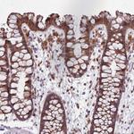 PPP1R27 Polyclonal Antibody