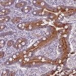 TMC4 Antibody in Immunohistochemistry (Paraffin) (IHC (P))