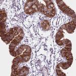 TMC4 Antibody in Immunohistochemistry (Paraffin) (IHC (P))