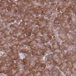 TMC4 Antibody in Immunohistochemistry (Paraffin) (IHC (P))
