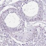 TMC4 Polyclonal Antibody