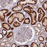 LDHD Antibody in Immunohistochemistry (IHC)