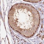 LDHD Antibody in Immunohistochemistry (IHC)