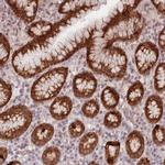 LDHD Polyclonal Antibody