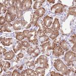 AAR2 Antibody in Immunohistochemistry (Paraffin) (IHC (P))