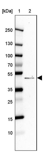 AAR2 Antibody in Western Blot (WB)