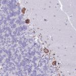 C20orf96 Antibody in Immunohistochemistry (Paraffin) (IHC (P))