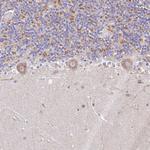 C19orf71 Antibody in Immunohistochemistry (Paraffin) (IHC (P))