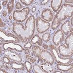 C19orf71 Antibody in Immunohistochemistry (Paraffin) (IHC (P))