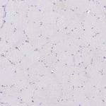 C19orf71 Antibody in Immunohistochemistry (Paraffin) (IHC (P))