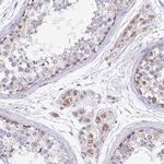 C19orf71 Antibody in Immunohistochemistry (Paraffin) (IHC (P))