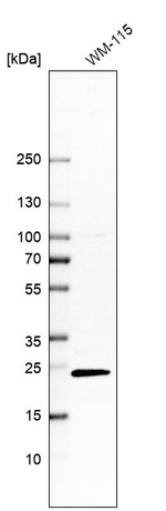 C19orf71 Antibody in Western Blot (WB)