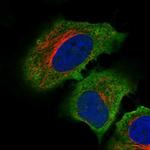 C19orf71 Polyclonal Antibody