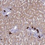 ZDHHC1 Polyclonal Antibody