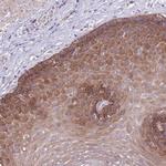 ZNF658 Antibody in Immunohistochemistry (Paraffin) (IHC (P))