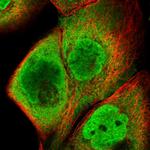 HIST1H2BC Polyclonal Antibody