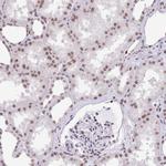 HIST1H2BC Antibody in Immunohistochemistry (Paraffin) (IHC (P))