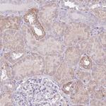 OR6M1 Polyclonal Antibody