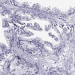 CROCC2 Antibody in Immunohistochemistry (IHC)