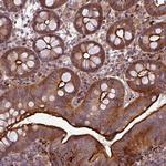 PAPLN Polyclonal Antibody