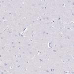 Acrosin Antibody in Immunohistochemistry (Paraffin) (IHC (P))