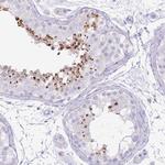 Acrosin Polyclonal Antibody