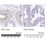 Acrosin Antibody in Immunohistochemistry (IHC)