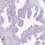 Acrosin Antibody in Immunohistochemistry (IHC)
