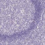 TINAGL1 Antibody in Immunohistochemistry (Paraffin) (IHC (P))