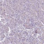 TINAGL1 Antibody in Immunohistochemistry (Paraffin) (IHC (P))