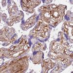 TINAGL1 Antibody in Immunohistochemistry (Paraffin) (IHC (P))