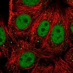 RFX1 Polyclonal Antibody