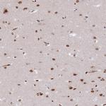 RFX1 Antibody in Immunohistochemistry (Paraffin) (IHC (P))